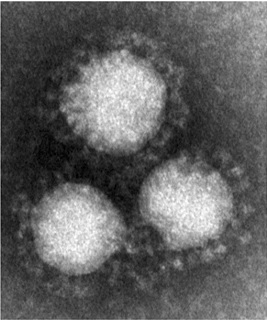 コロナウイルスの電子顕微鏡写真.jpg